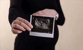 pregnant lady holding a sonography image
