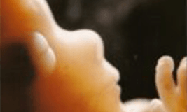 First trimester baby picture